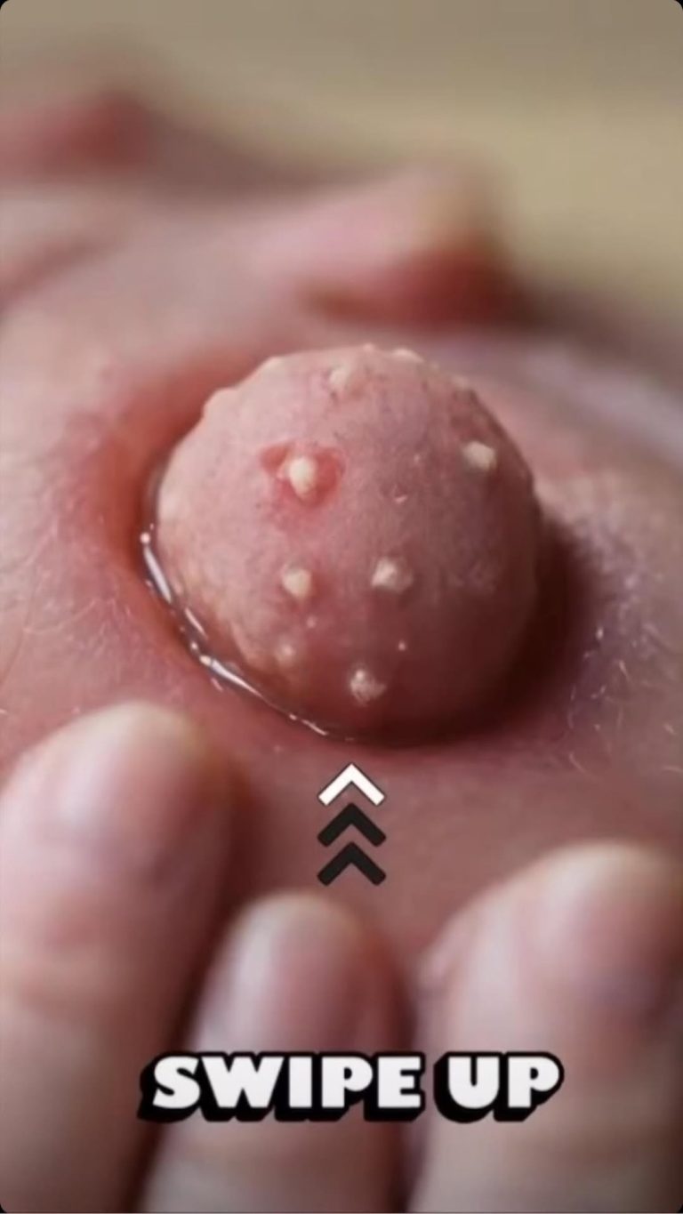 Be Aware Of THIS: These 9 Changes On Your Tongue Reveal Almost All Your Diseases