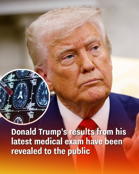 is latest medical exam have been revealed to the public