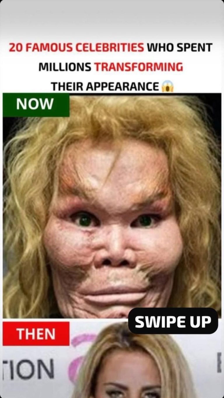 Well-known Stars Who Spent Millions Changing Their Looks