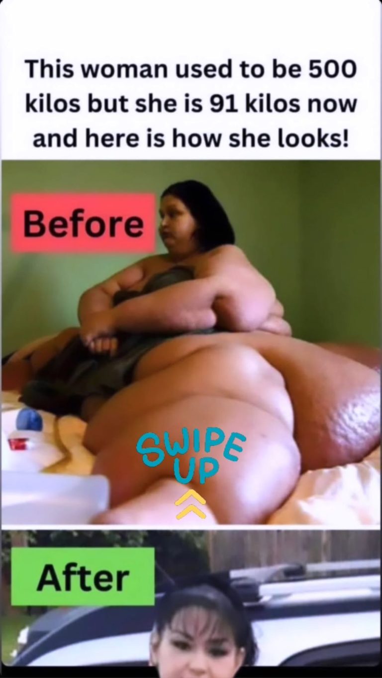 10 Of The Biggest Weight Loss Transformations Of All Time