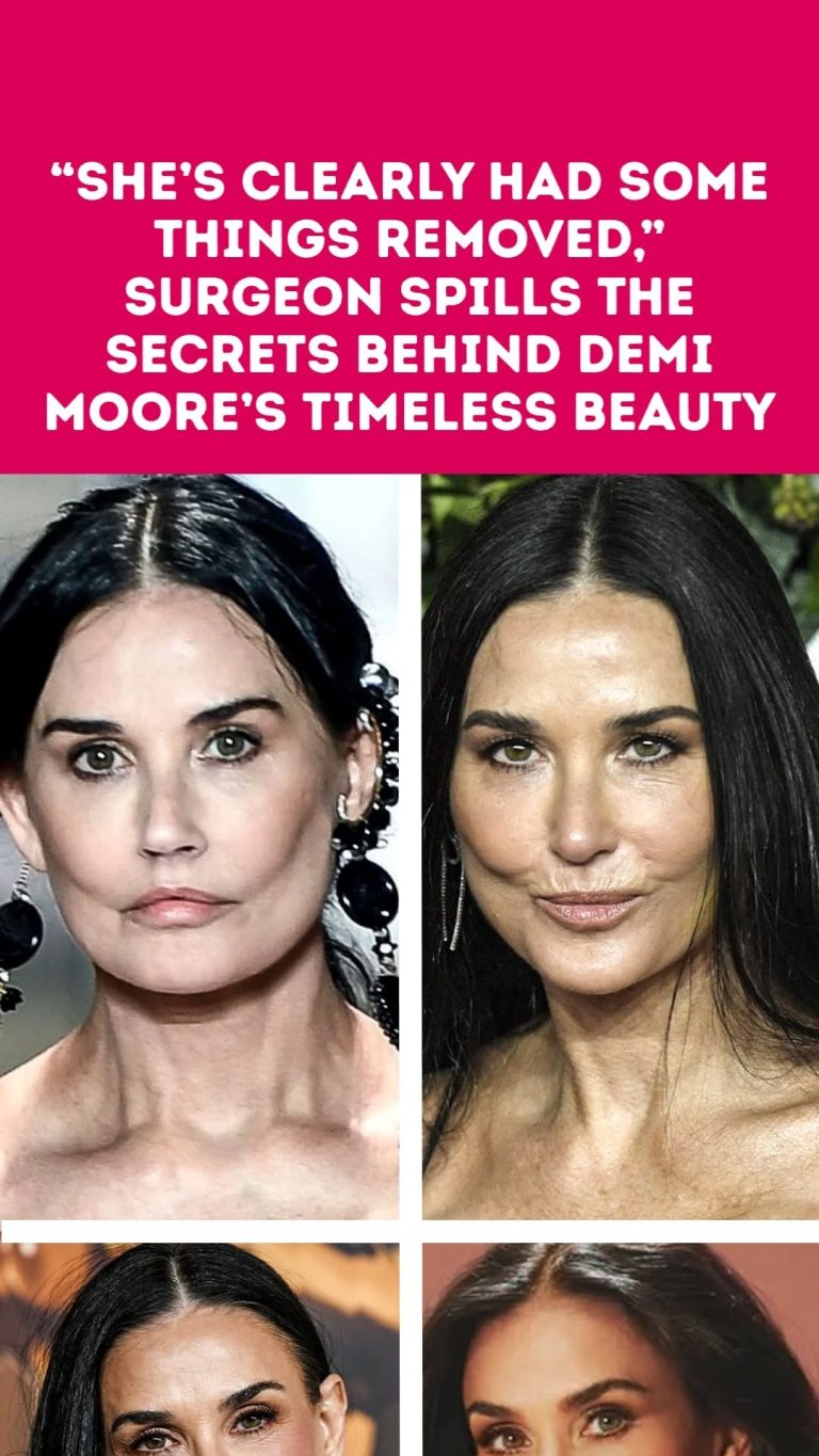“She’s Clearly Had Some Things Removed,” Surgeon Spills the Secrets Behind Demi Moore’s Timeless Beauty