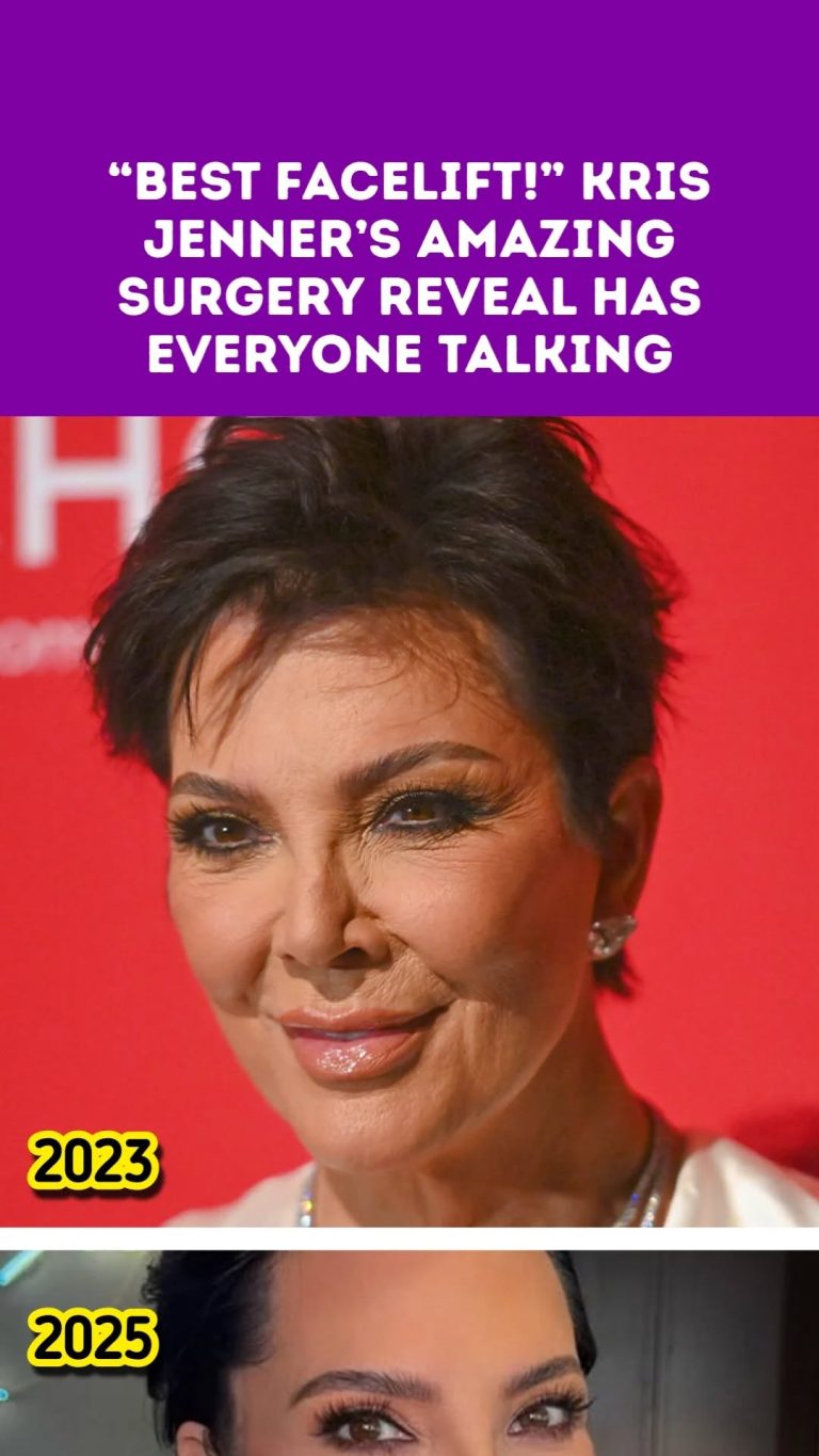 “Best Facelift!” Kris Jenner’s Amazing Surgery Reveal Has Everyone Talking