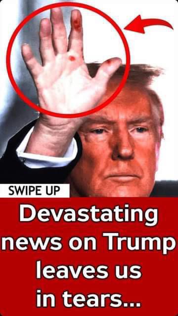 Men’s Health Specialist Finally Reveals Why Trump Has Recurring ‘Black Spots’ On His Hands, And We Had No Idea