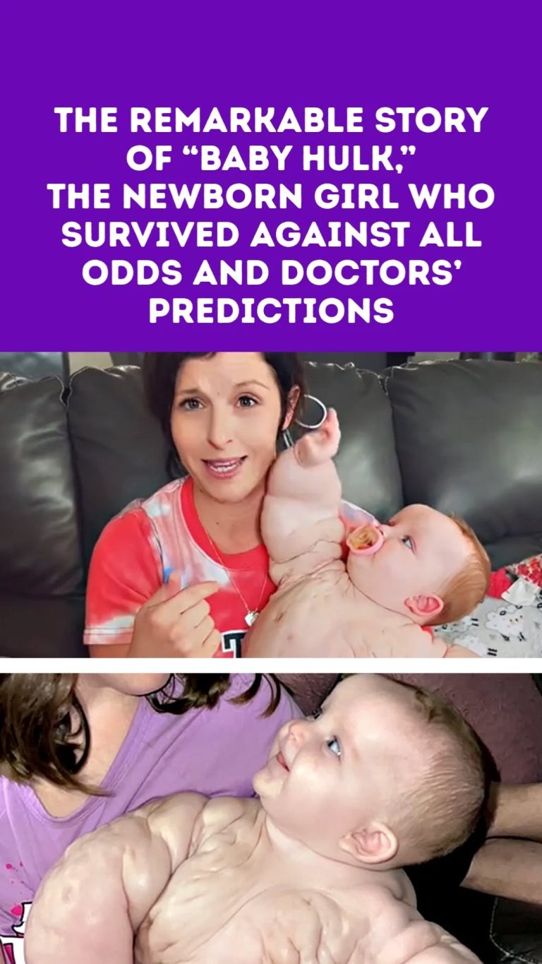 The Remarkable Story of “Baby Hulk,” the Newborn Girl Who Survived Against All Odds and Doctors’ Predictions