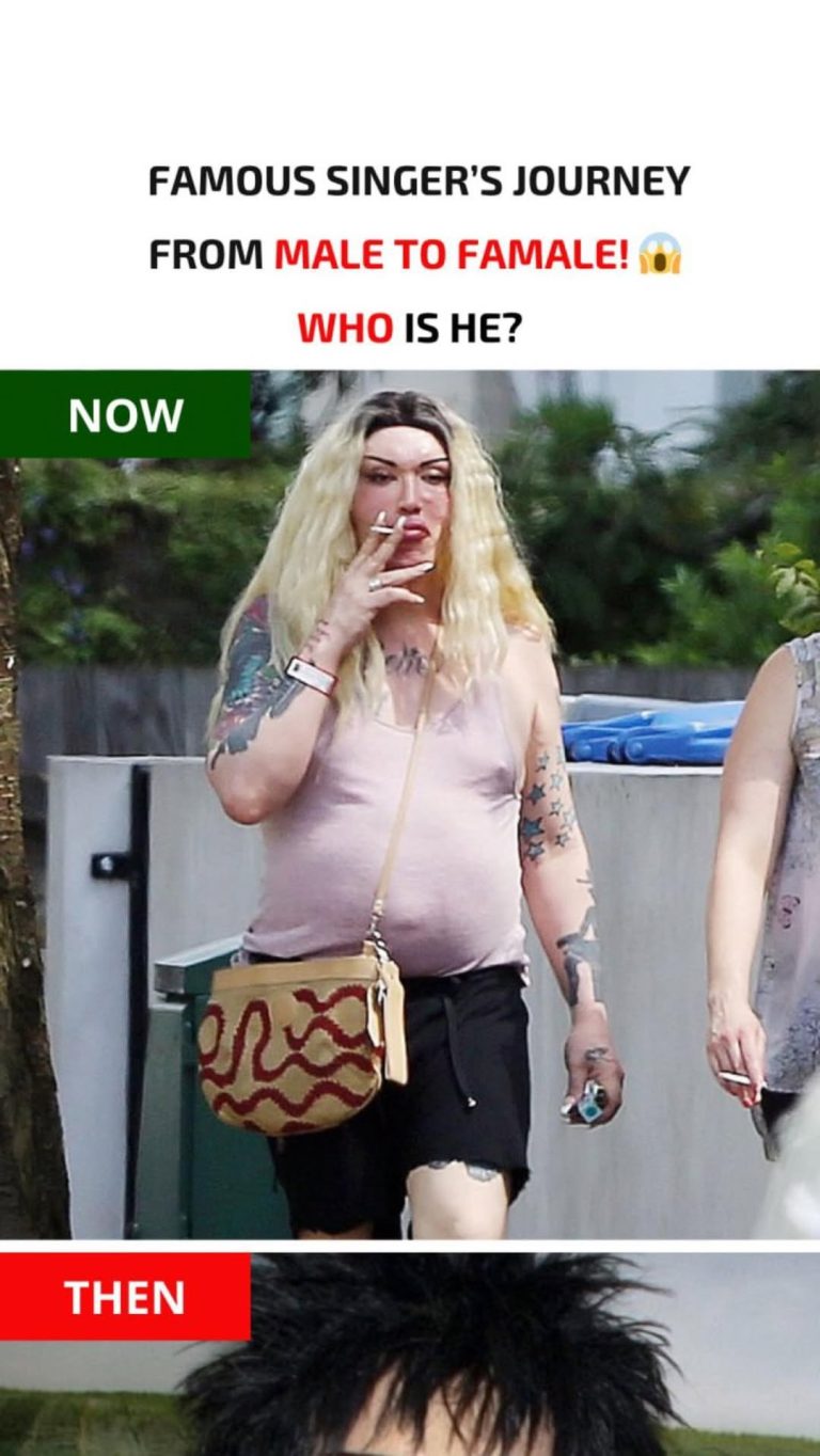 Pete Burns’ Changing Looks: ‘Right Round’ Singer’s Plastic Surgery Obsession in His Own Words