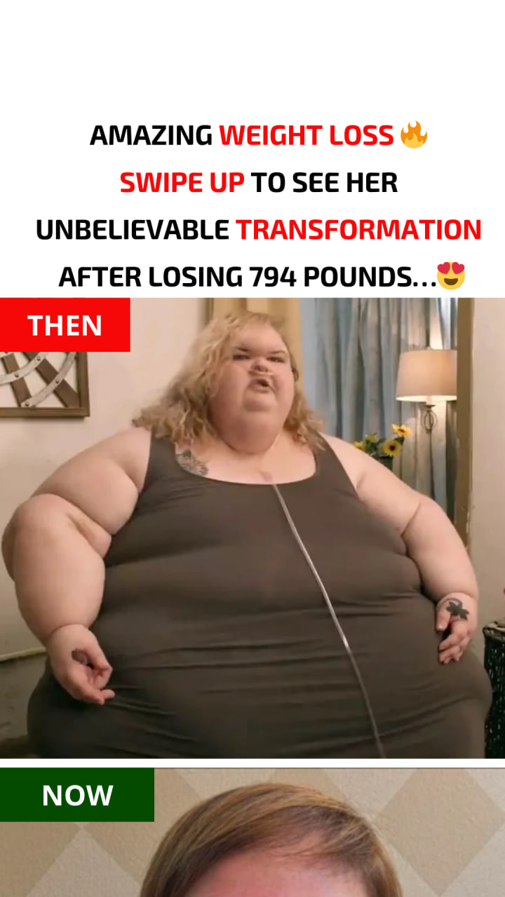 “Sisters Weighing One Thousand Pounds” As a result of her dramatic transformation, the star has become an inspiration to a great number of people…