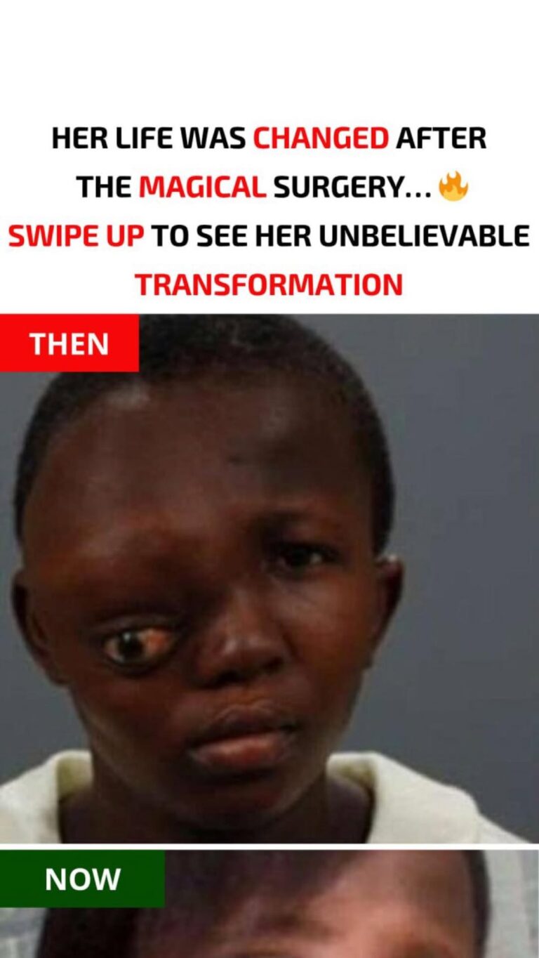 “People were scared of me, they would start running,” said an African girl who underwent a unique brain operation in Atlanta to remove a big tumor…